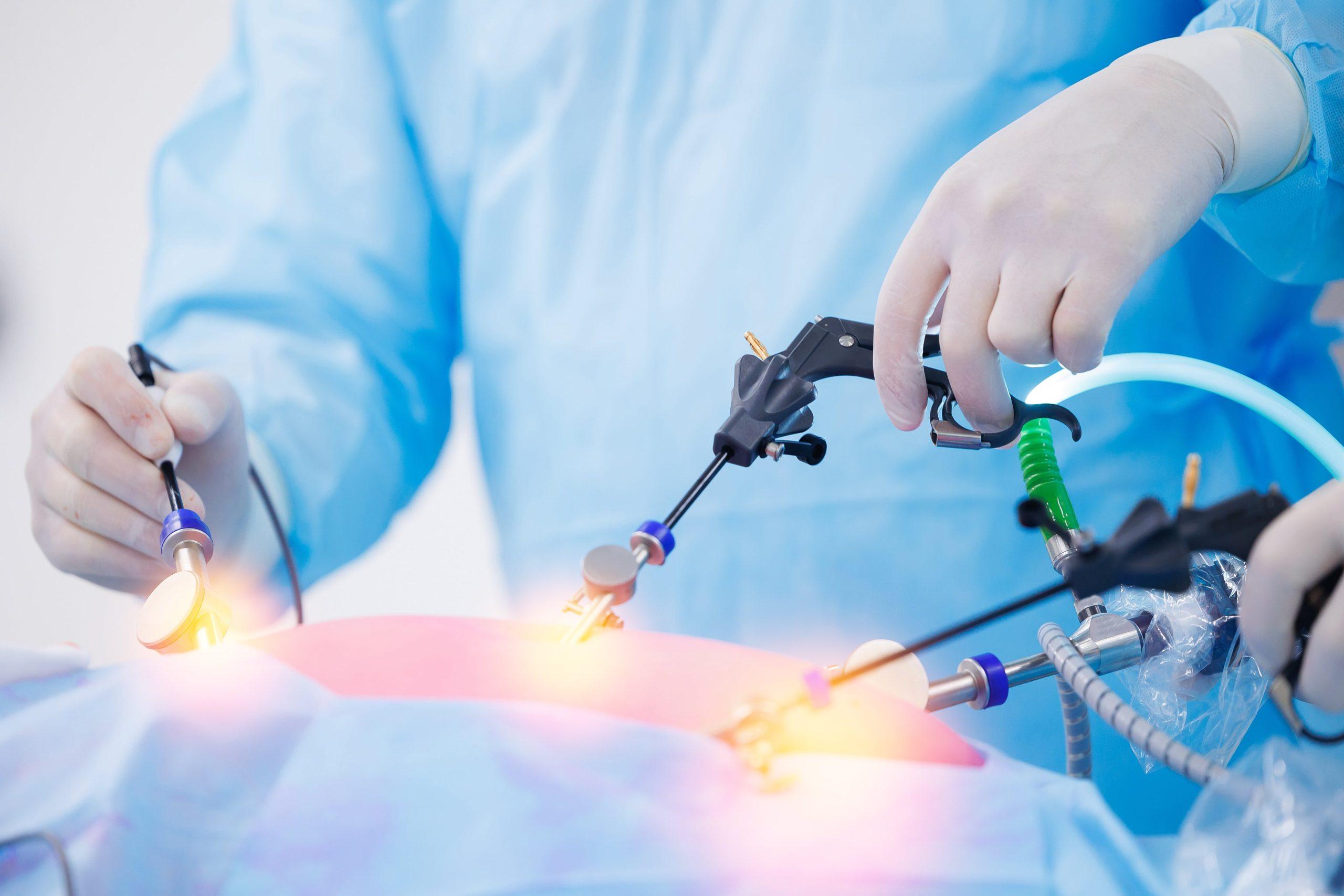 Why Medical Institutions Are Rapidly Adopting 3D Camera Laparoscopic Surgical Systems
