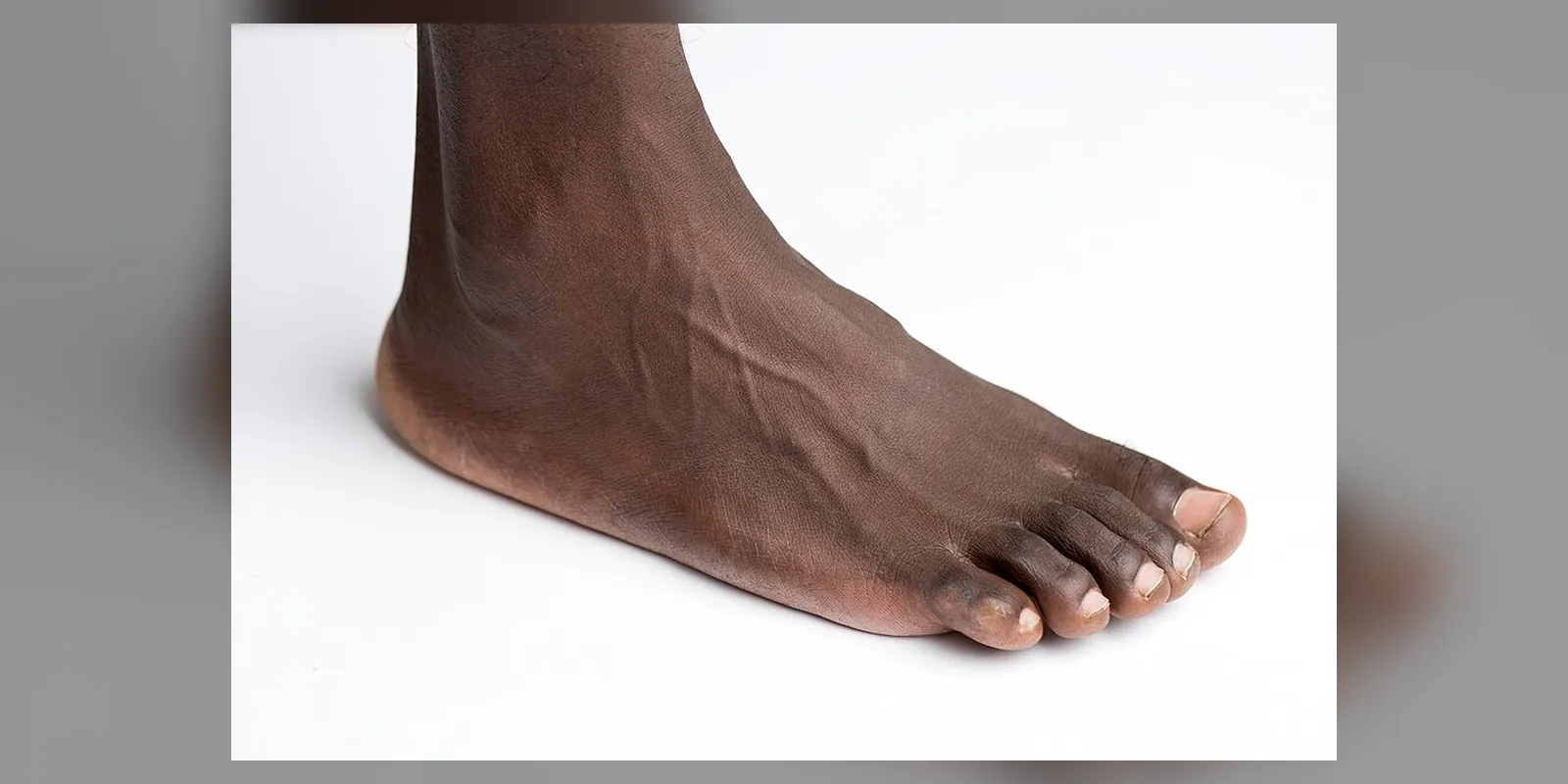 Human foot (right)