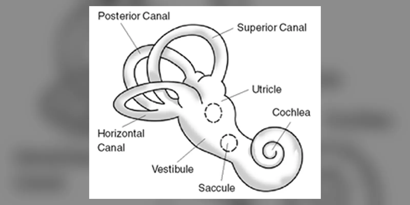 Balance Disorder Illustration A