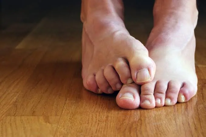 What Your Feet May Be Telling You About Your Health: Key Signs to Watch For