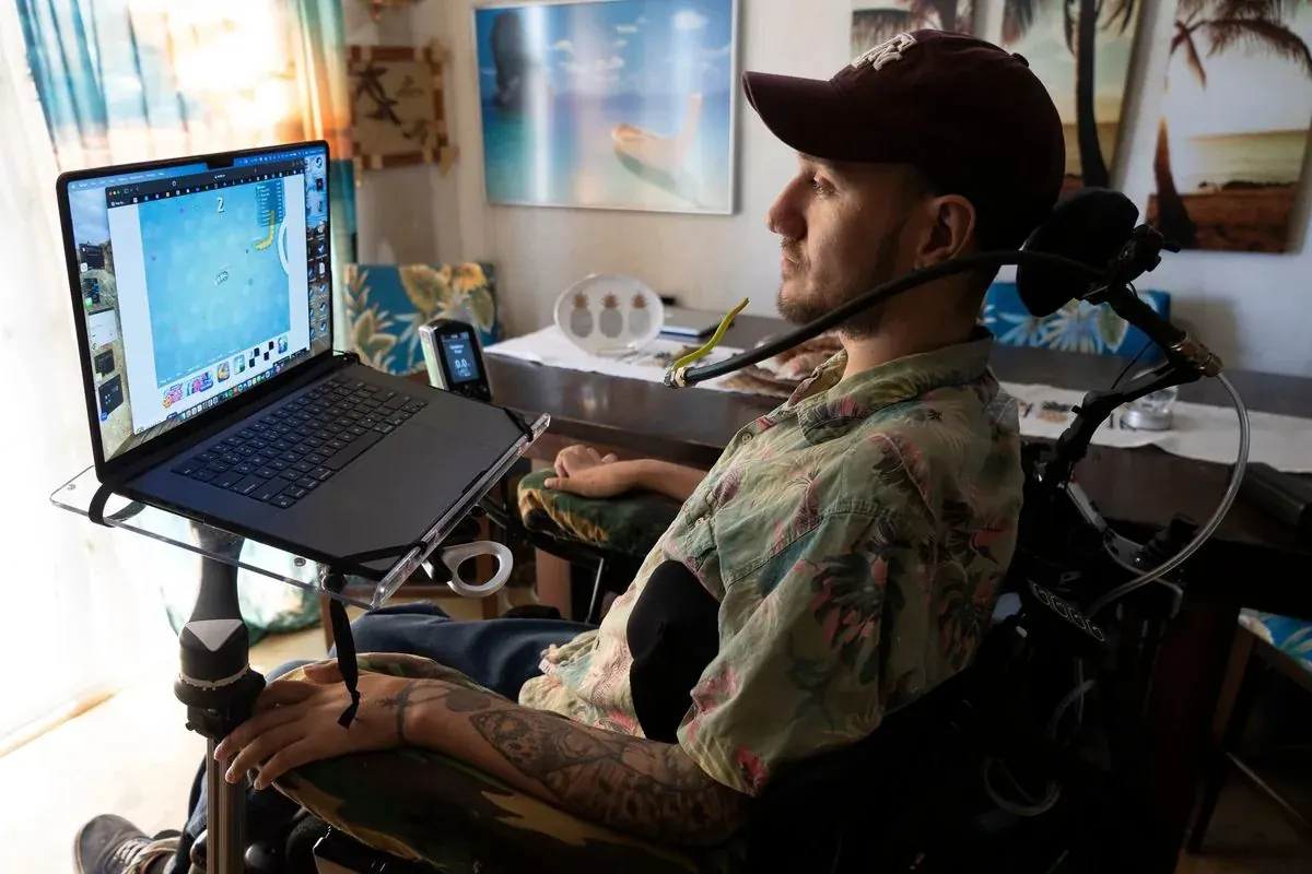 How Brain Implants Are Transforming Healthcare and Medical Treatments