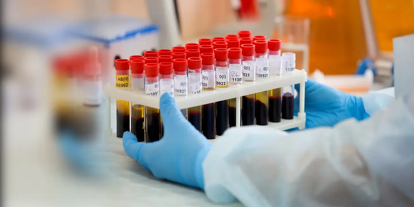 New Human Blood Group System: MAL Solves 50 Year Mystery