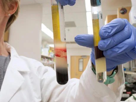 The Latest Breakthroughs In Cancer Treatment That Could Change Lives Forever