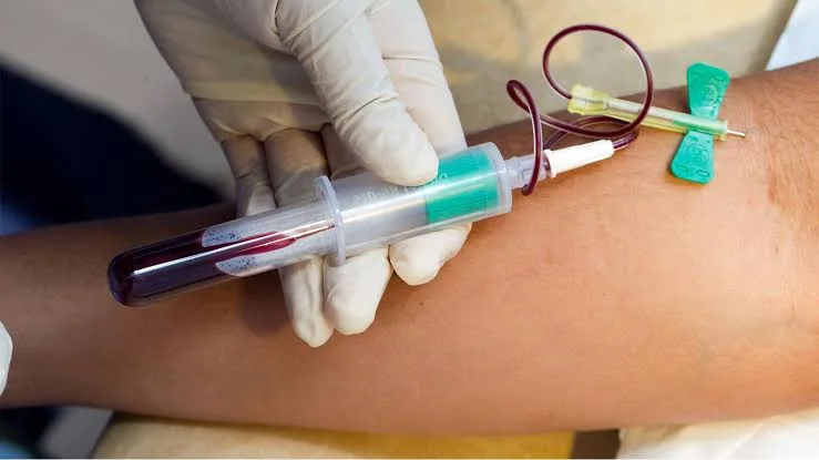 The Importance of Regular Blood Tests: Key Insights for Monitoring Your Health