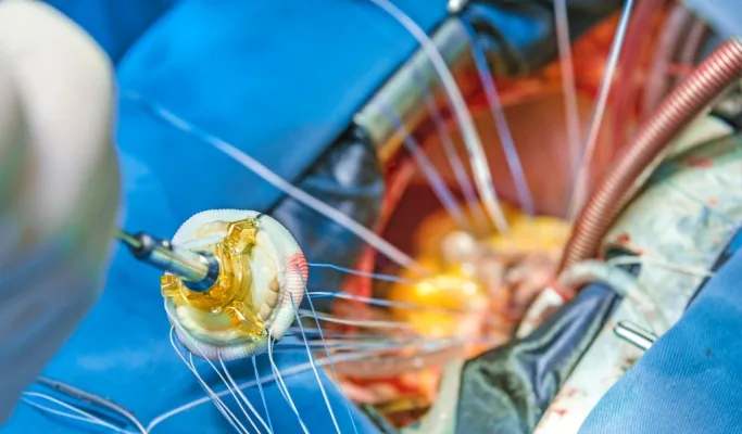 Discover the Warning Signs That May Lead to an Urgent Artery Replacement