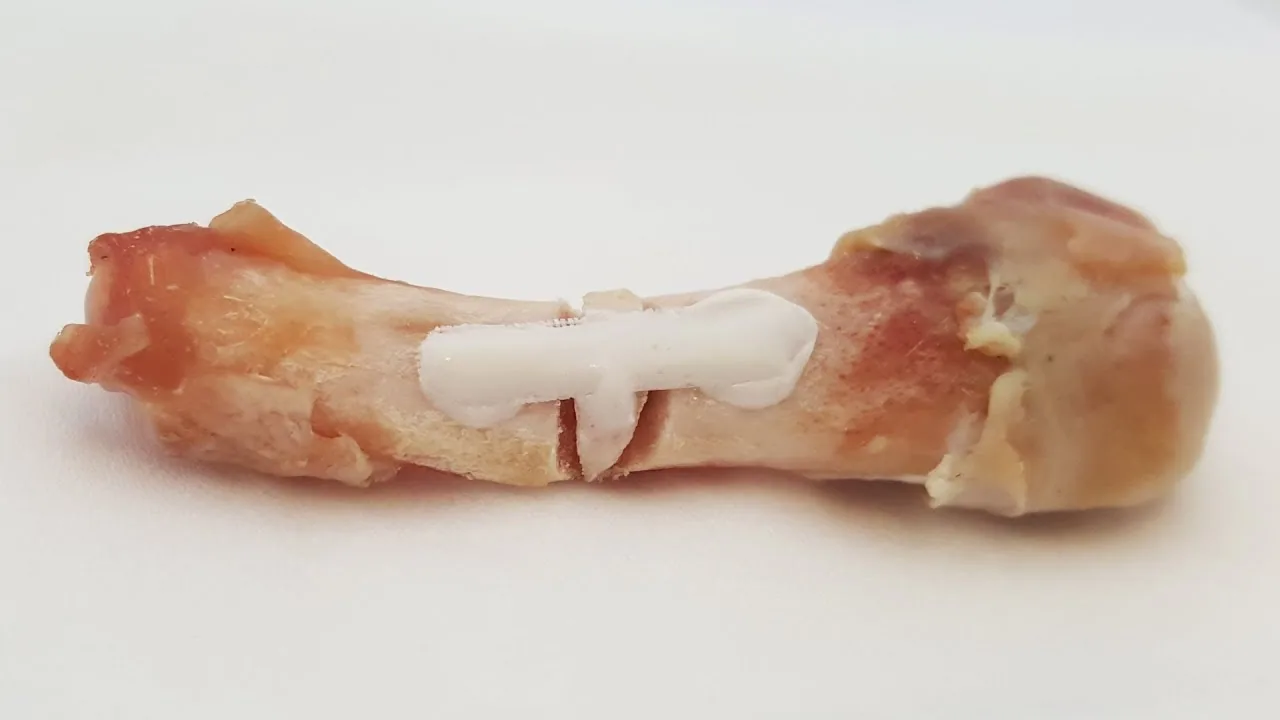 A Simple Glue Could End the Era of Metal Plates in Bone Repair
