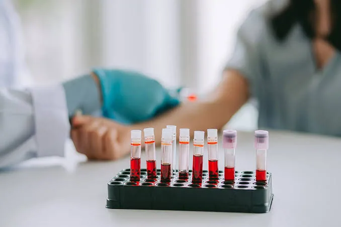 Basic Metabolic Panel (BMP): The Test That Tells You More Than You Thinking