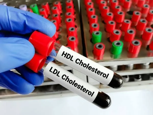 Lipid Panel (Cholesterol Test): What Your Numbers Really Mean