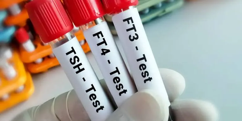Thyroid Function Test (TFT): What Your Results Reveal About Your Health