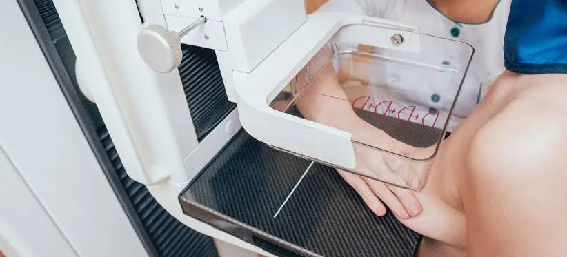 Mammograms: The Scan That Could Save Your Life