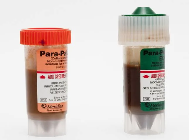 Stool Tests: What Your Gut Can Reveal About Your Health