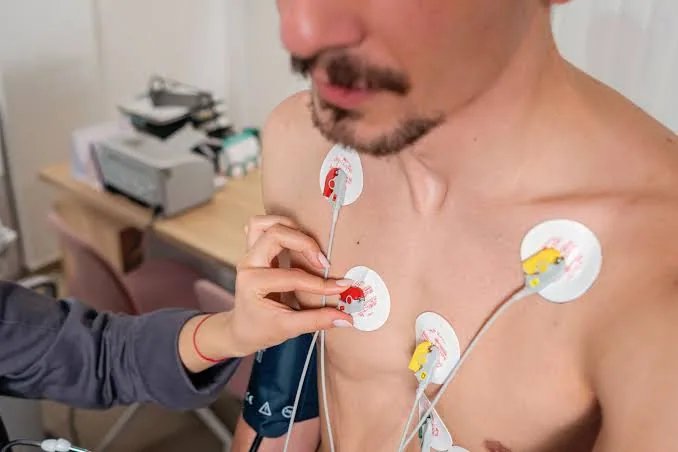 ECG/EKG Monitors:Your Heart Doesn’t Always Warn You: But This Device Can