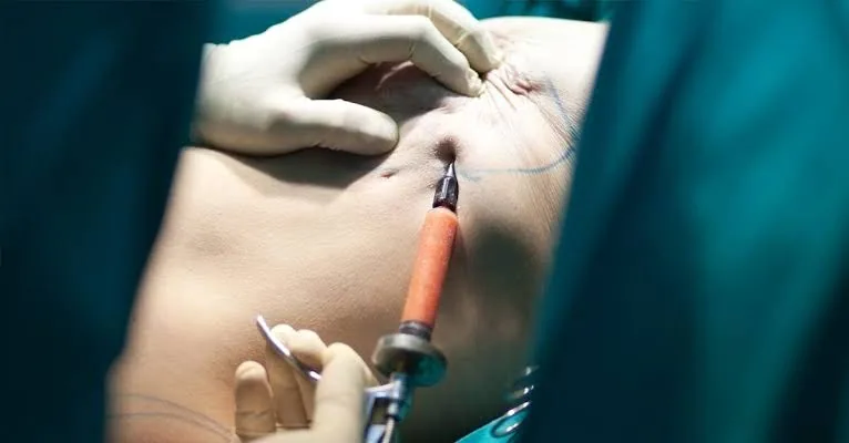 Mastectomy: What to Expect Before, During, and After Surgery
