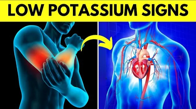 Signs of Low Potassium: How Many Do You Have?