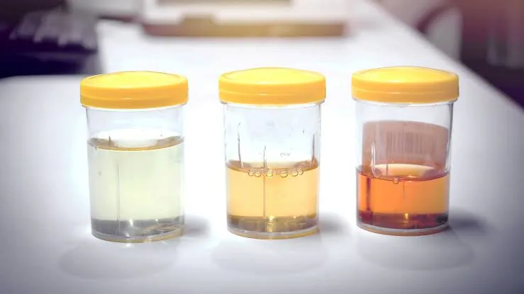 Is Human Urine Safe? What Science Really Says About Drinking or Using It