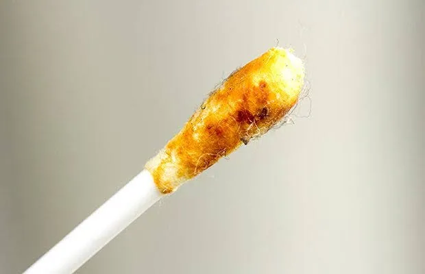 Why Cleaning Your Ears with Cotton Swabs Can Be Dangerous