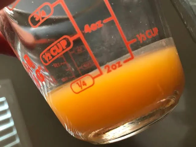 Is Urine Really Sterile? The Science Behind This Common Health Myth