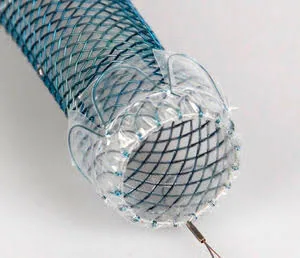 Mastering Stents: A Comprehensive Guide to Types, Placement, and Medical Applications