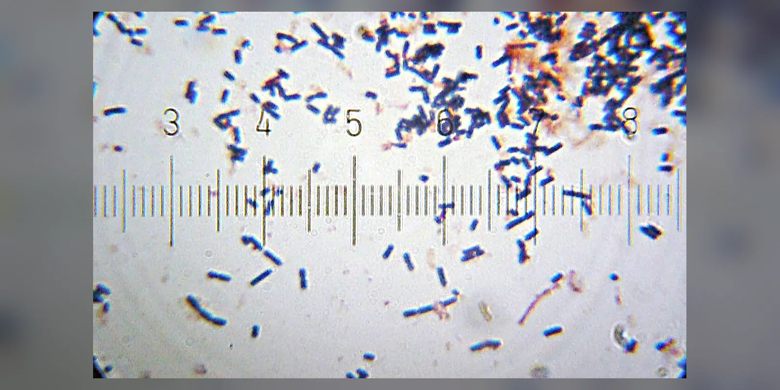 Lactobacillus acidophilus bacteria under a microscope