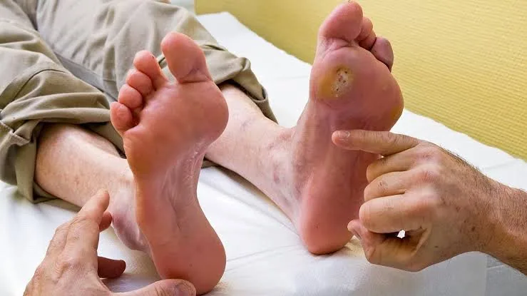 What Your Feet May Be Telling You About Your Health: Key Signs to Watch For
