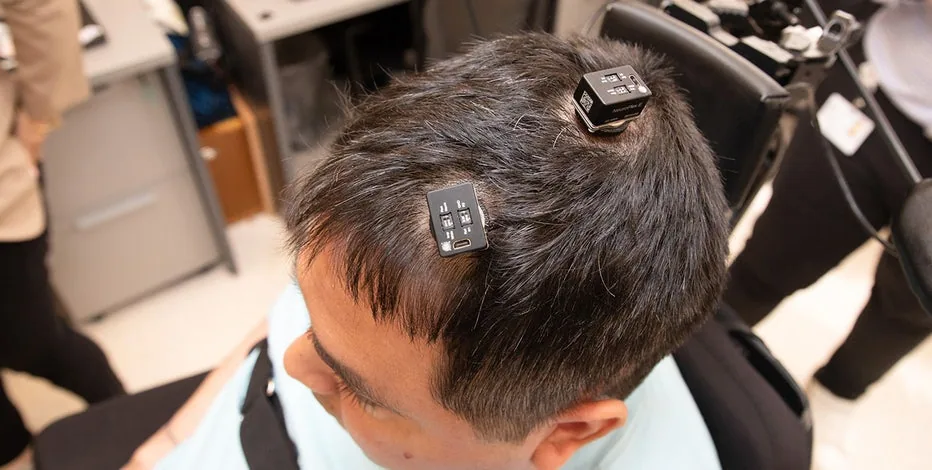 How Brain Implants Are Transforming Healthcare and Medical Treatments