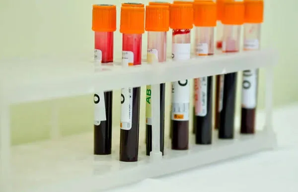 New Human Blood Group System: MAL Solves 50 Year Mystery