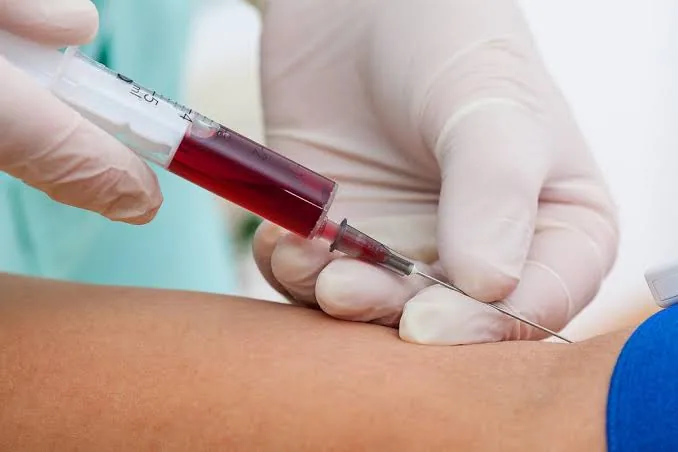 The Importance of Regular Blood Tests: Key Insights for Monitoring Your Health