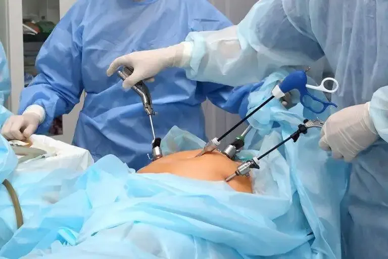 Why Medical Institutions Are Rapidly Adopting 3D Camera Laparoscopic Surgical Systems