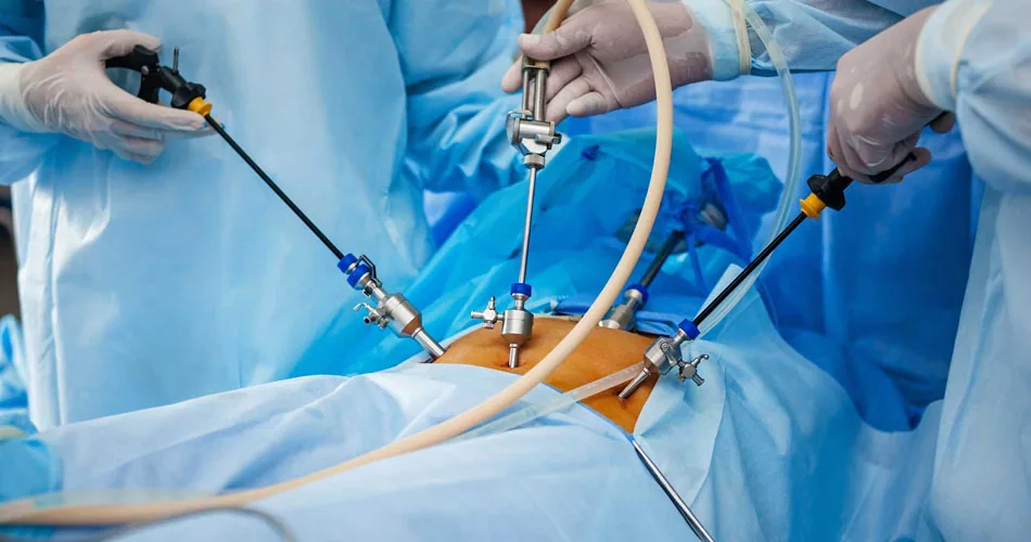 Why Medical Institutions Are Rapidly Adopting 3D Camera Laparoscopic Surgical Systems