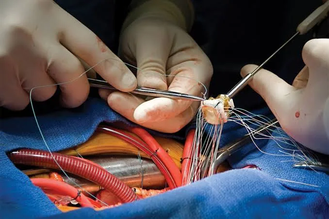 Discover the Warning Signs That May Lead to an Urgent Artery Replacement