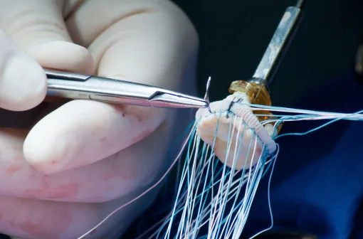 Discover the Warning Signs That May Lead to an Urgent Artery Replacement