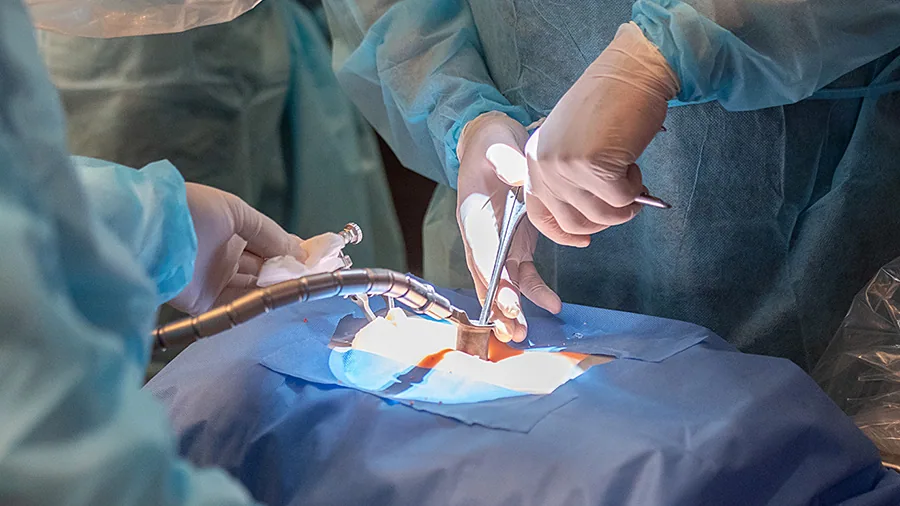 Breaking Down the Science Behind Successful Artery Replacement Procedures