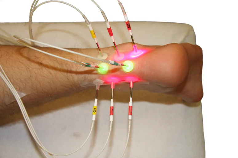 Why Laser Powered Surgery Is Becoming The Future Of Delicate Medical Procedures