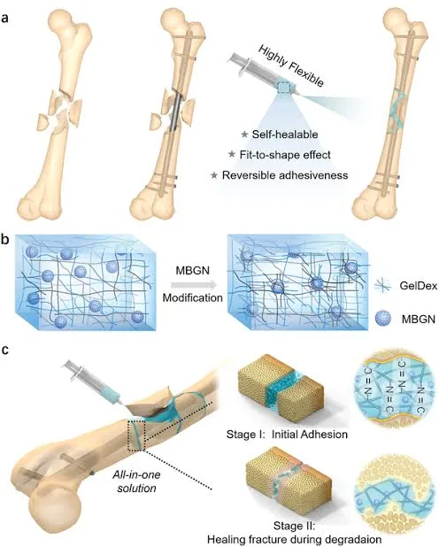 A Simple Glue Could End the Era of Metal Plates in Bone Repair