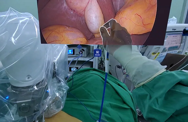 This New Surgical Technology Lets Doctors Navigate the Body Like a 3D Map