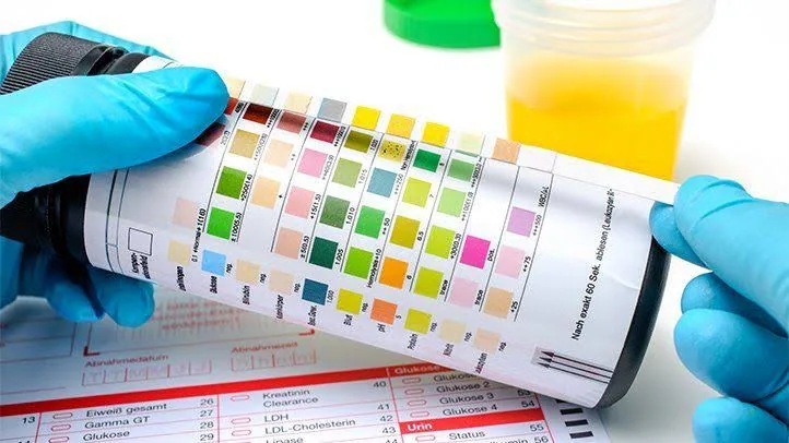 Understanding the Role of Urinalysis in Routine Health Check-ups