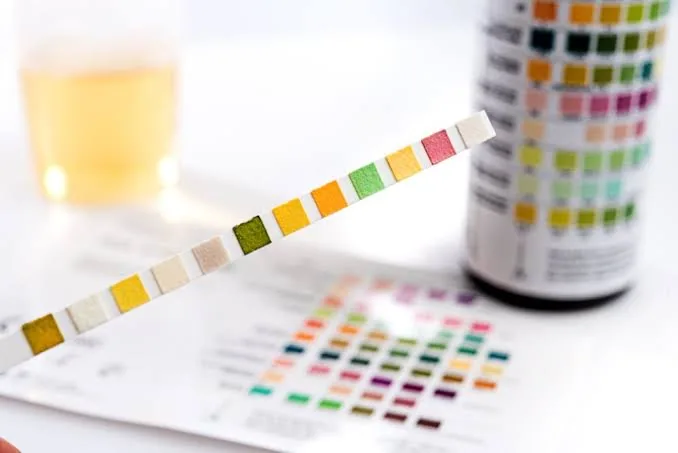 Understanding the Role of Urinalysis in Routine Health Check-ups