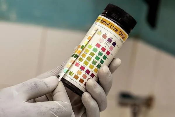 Understanding the Role of Urinalysis in Routine Health Check-ups