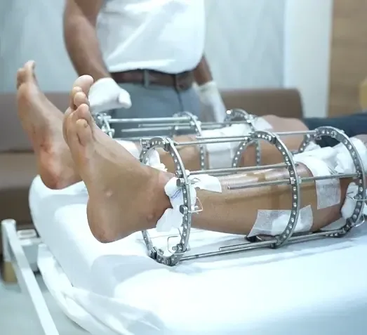 See How Surgeons Use Metal Rods to Make a Woman 13 Inches Taller