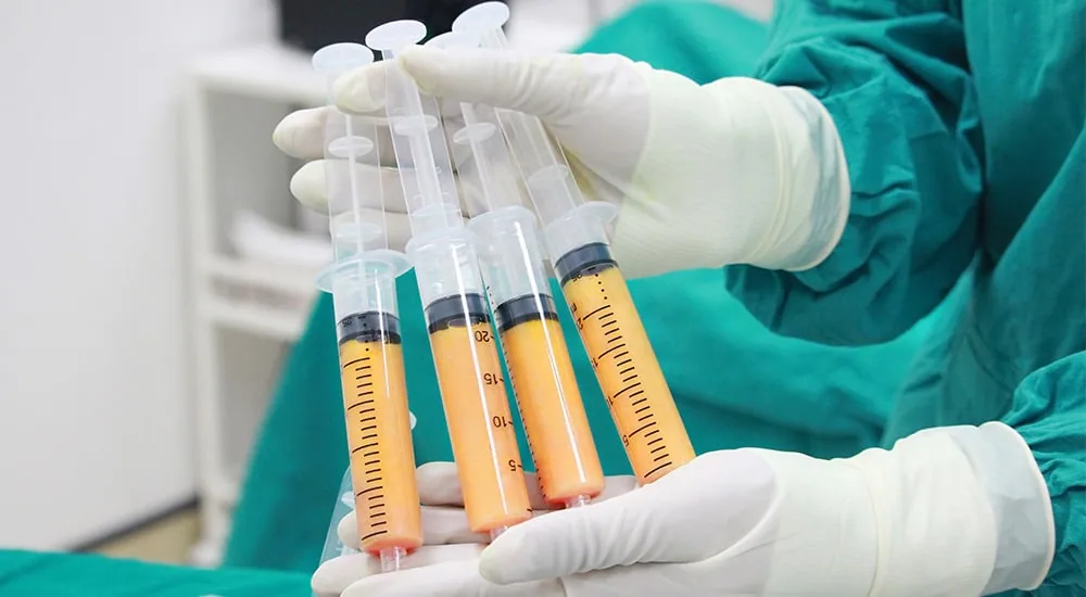 Why BBL Surgery Has Become the Most Talked About Body Procedure Today