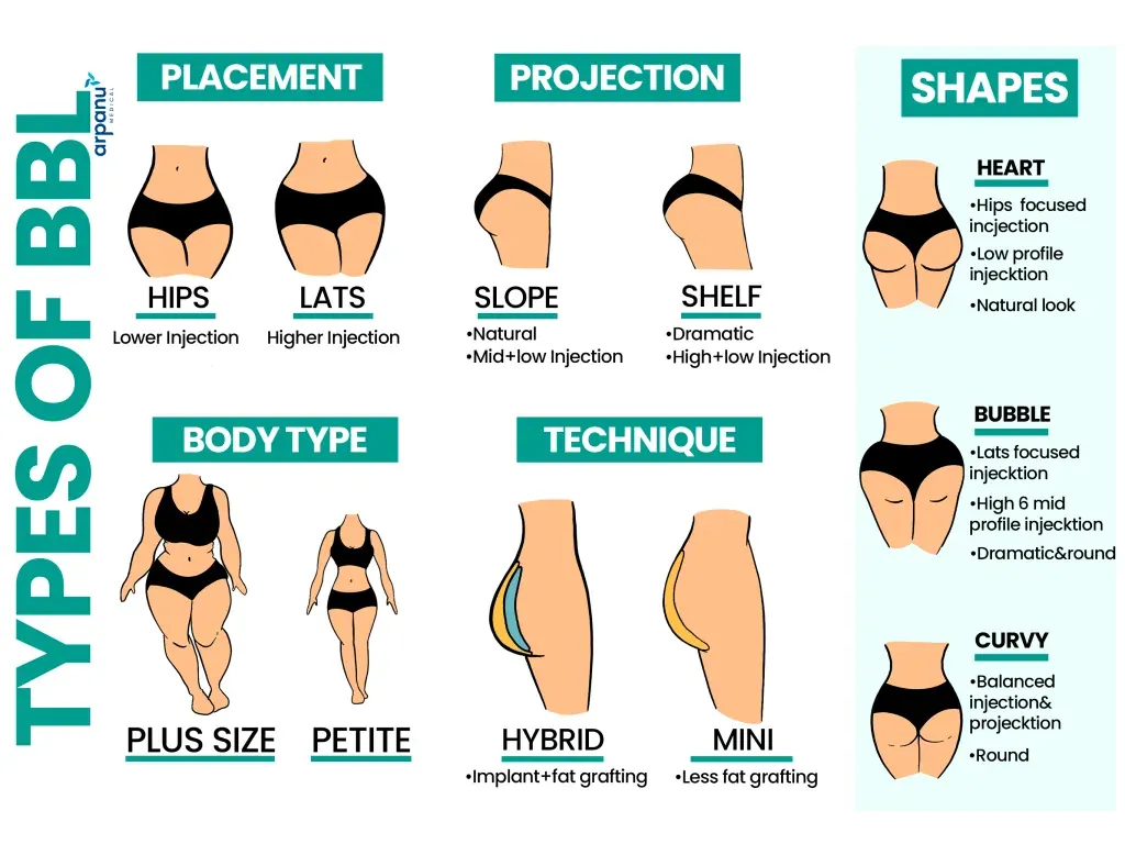 What You Must Know Before Choosing a BBL Procedure for Your Dream Shape