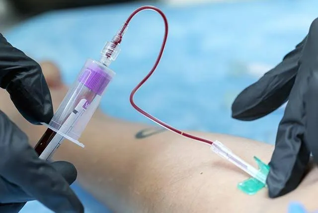 Complete Blood Count (CBC): The Silent Guardian of Your Health