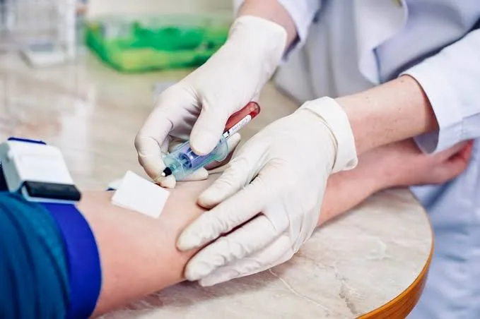 Liver Function Tests (LFTs): A Snapshot of Your Liver Health
