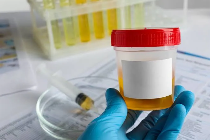 Microbiological Tests: The Key to Identifying Hidden Infections