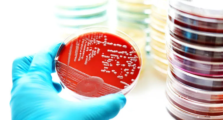 Microbiological Tests: The Key to Identifying Hidden Infections