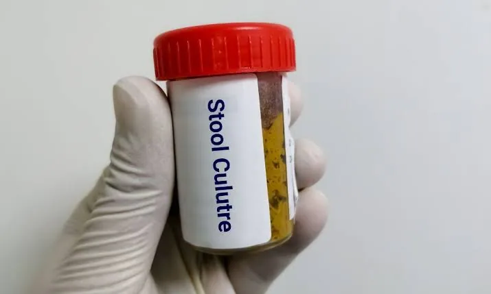 Microbiological Tests: The Key to Identifying Hidden Infections