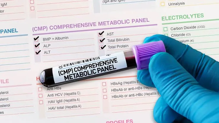 Basic Metabolic Panel (BMP): The Test That Tells You More Than You Thinking