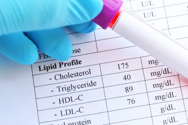 Lipid Panel (Cholesterol Test): What Your Numbers Really Mean