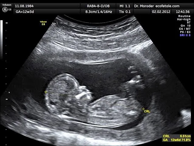 Ultrasound: More Than Just Baby Pictures