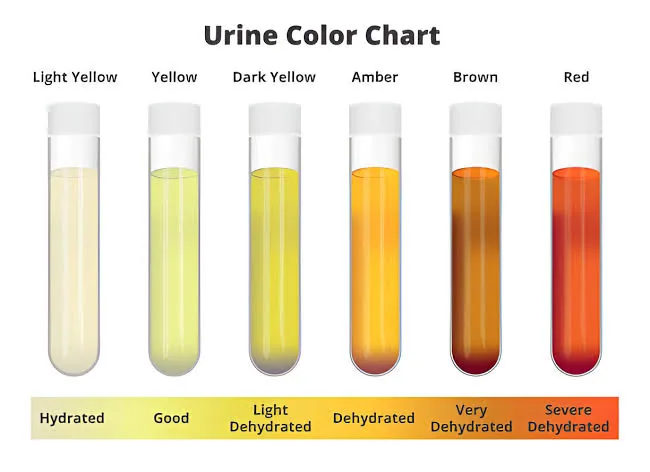 What Your Pee Says About Your Health (And Why You Should Listen)